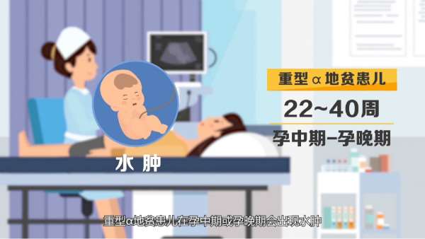 重型a地贫患儿怀孕中期